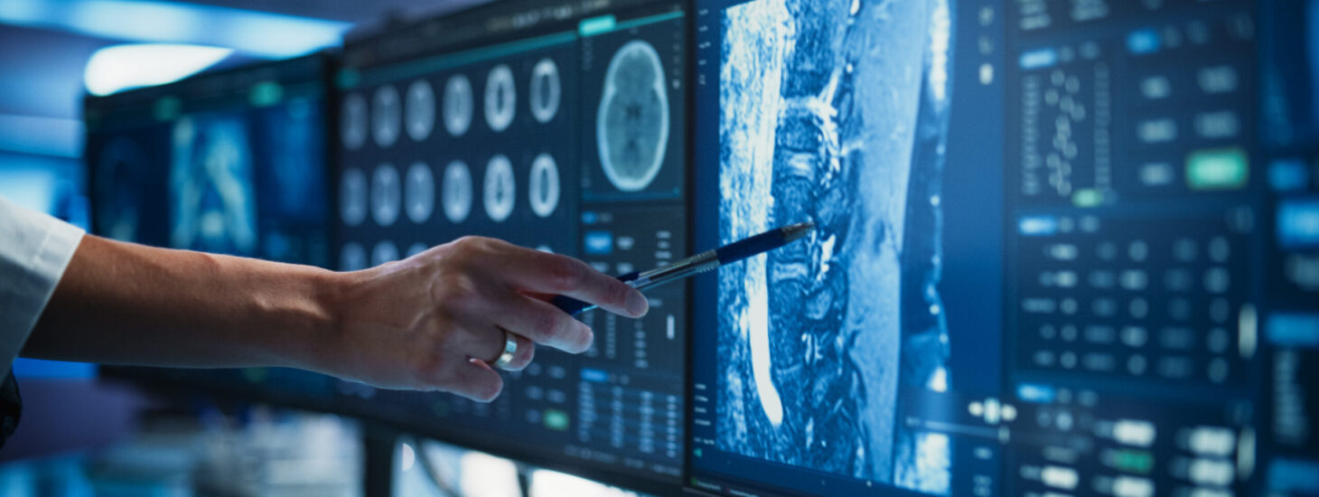 A healthcare professional pointing at a diagnostic image